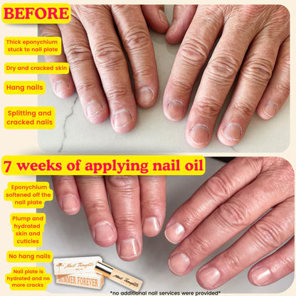 Nail Thoughts Summer Forever Nail Oil, 10ml